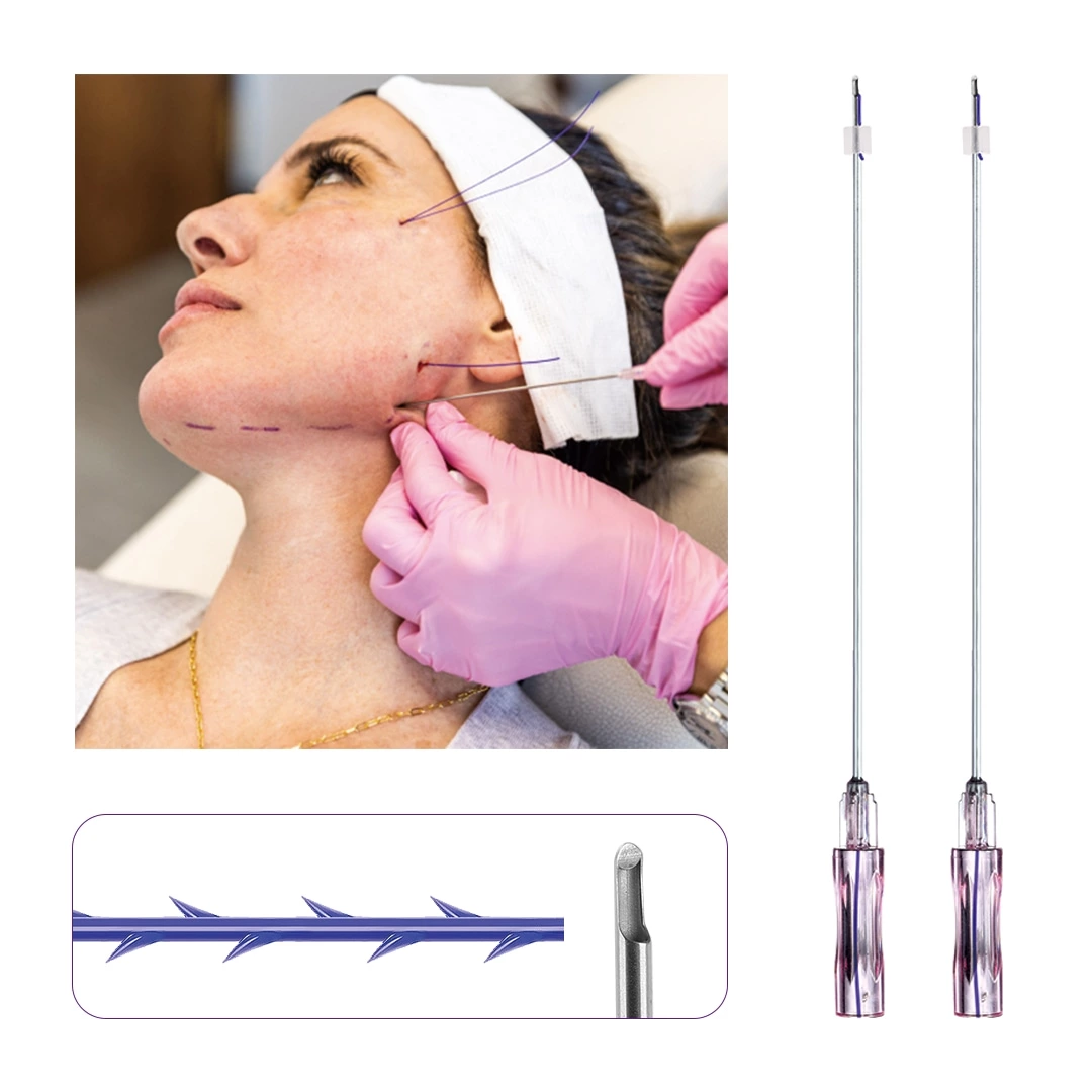Face Lift PDO 2-1 3-1 4-1 5-1  Thread