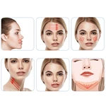 Skin Filling Smooth PDO Mono Thread