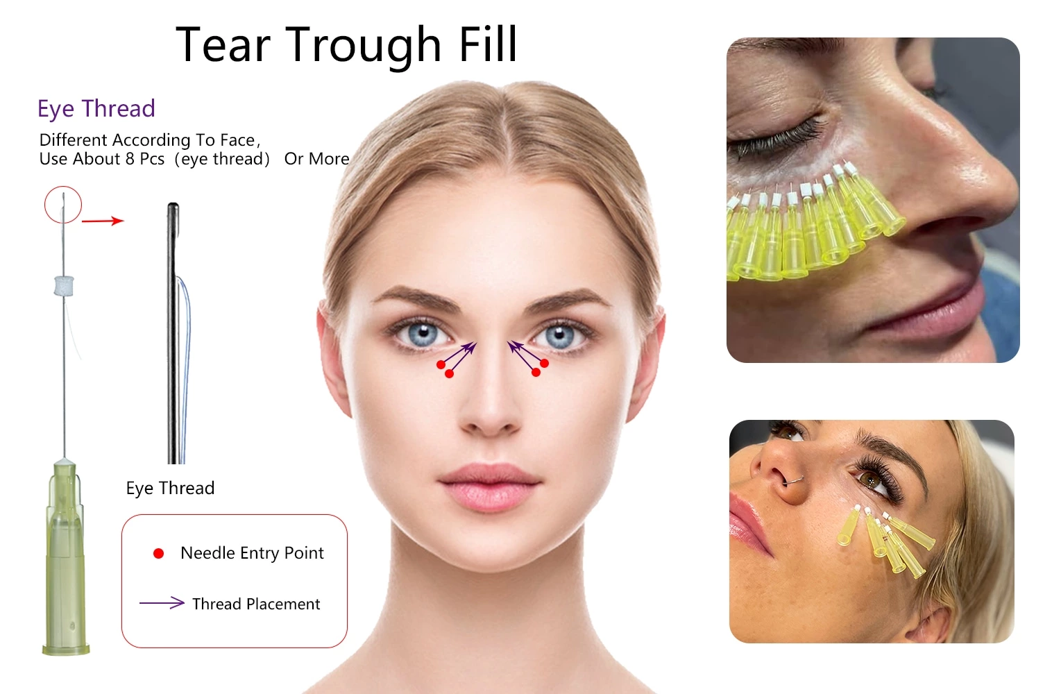 PDO Mesh Thread