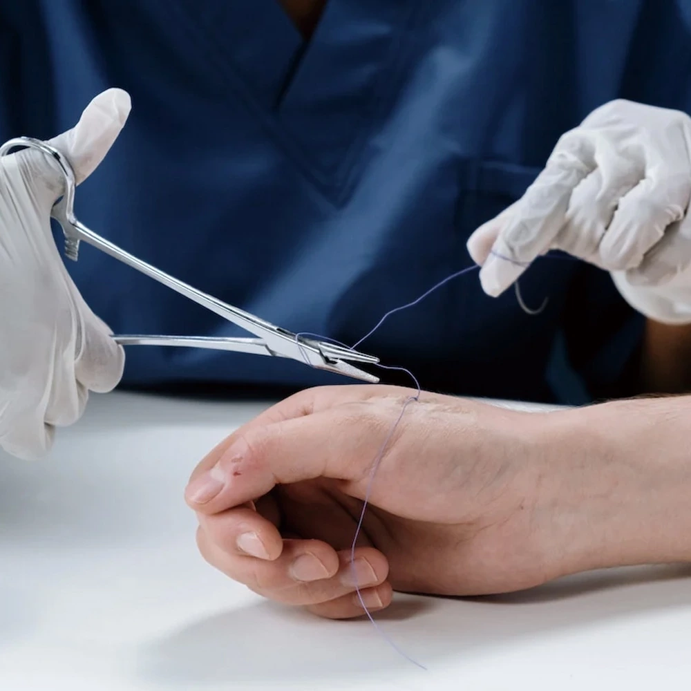 Surgical Sutures