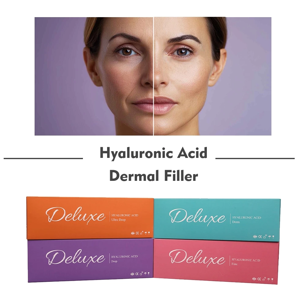 Cross Linked Hyaluronic Acid Injectable Gel Lip Augmentation Dermal Filler