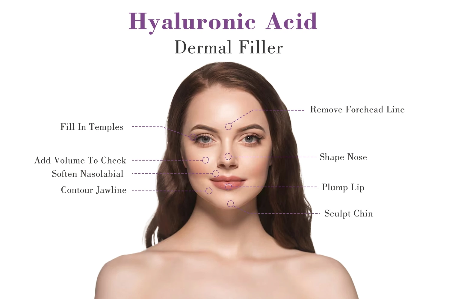 Cross Linked Hyaluronic Acid Injectable Gel Lip Augmentation Dermal Filler