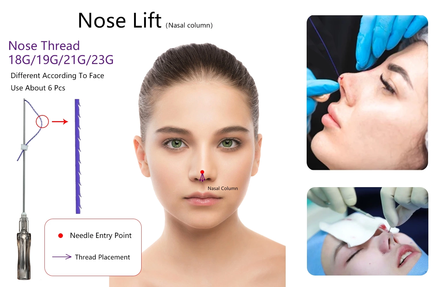 PDO Nose Thread
