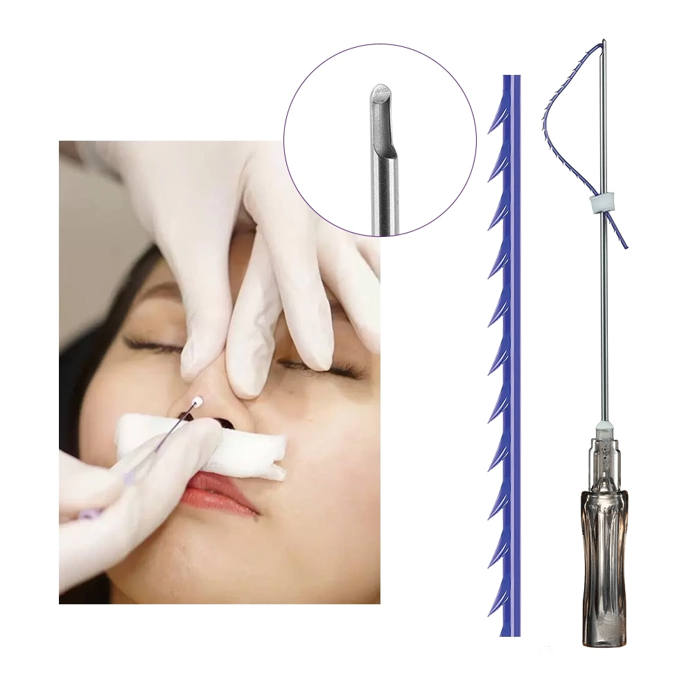PDO Nose Thread