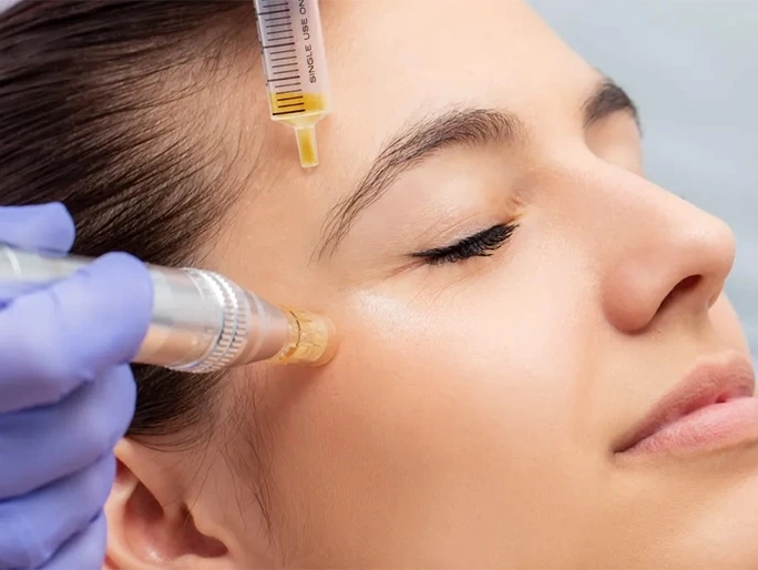 Injection Dermal Filler Needle