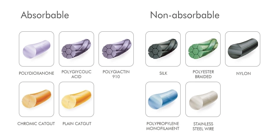 Raw Material Classification