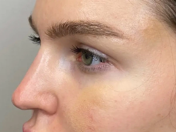 Filling &Lifting & Tightening