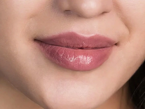 Skin Filling & Wrinkle Removal
