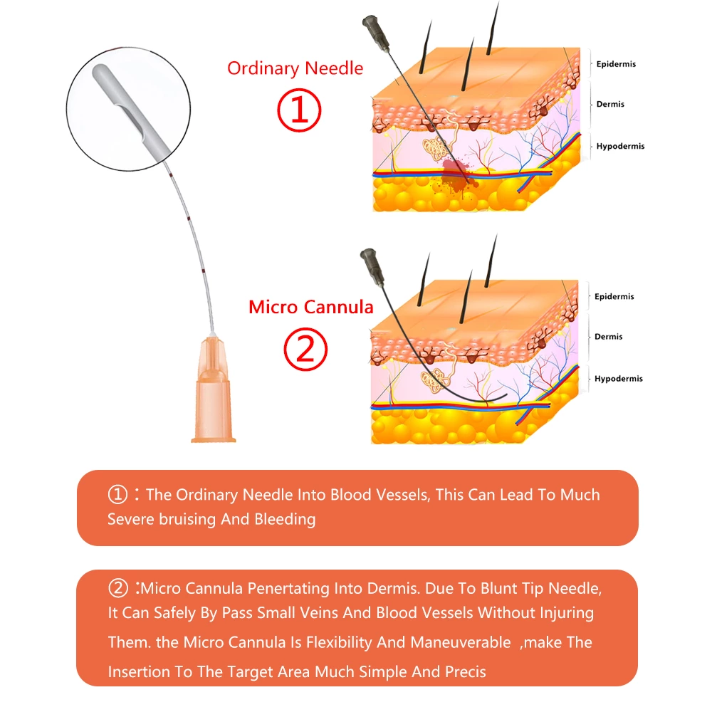 Blunt Needles - Advantages & Clinical Uses