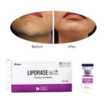 Liporase (Hyaluronidase) Dissolve Dermal Filler